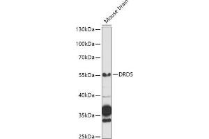 Western blot analysis of extracts of Mouse brain, using DRD5 antibody (ABIN3022432, ABIN3022433, ABIN3022434 and ABIN6218817) at 1:1000 dilution. (DRD5 Antikörper  (AA 323-477))