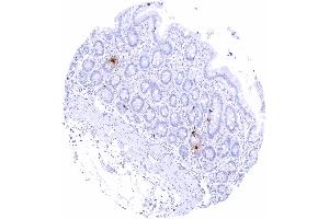 Duodenum mucosa Intense somatostatin staining of scattered neuroendocrine delta cells (Rekombinanter Somatostatin Antikörper)