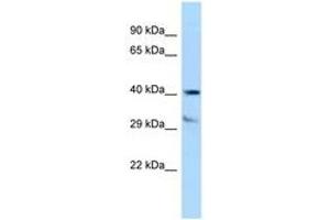 Image no. 1 for anti-Tocopherol (Alpha) Transfer Protein (TTPA) (AA 204-253) antibody (ABIN6747970)