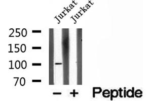 Western blot analysis of extracts of Jurkat cells, using OTUD7B antibody. (OTUD7B Antikörper  (C-Term))