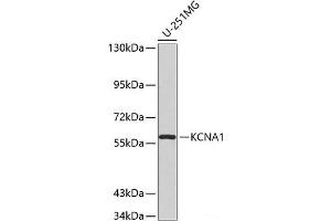 Western blot analysis of extracts of U-251MG cells using KCNA1 Polyclonal Antibody. (KCNA1 Antikörper)