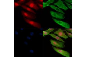 Phospho-TMS1/ASC (Ser195) Antibody staining A549 cells(H2O2 treatment) by IF/ICC. (PYCARD Antikörper  (pSer195))