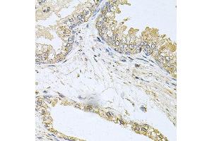 Immunohistochemistry of paraffin-embedded human prostate using BCR antibody at dilution of 1:100 (x40 lens).