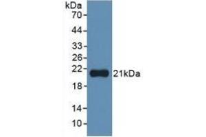 Detection of Recombinant IL1a, Human using Monoclonal Antibody to Interleukin 1 Alpha (IL1a) (IL1A Antikörper  (AA 113-271))