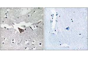 Immunohistochemistry analysis of paraffin-embedded human brain tissue, using FAK (Ab-925) Antibody. (FAK Antikörper  (AA 892-941))