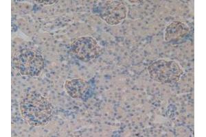 IHC-P analysis of Rat Kidney Tissue, with DAB staining. (PODXL Antikörper  (AA 153-386))