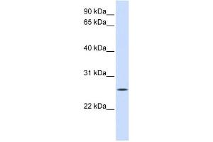 UNC50 antibody used at 1 ug/ml to detect target protein. (UNC50 Antikörper)