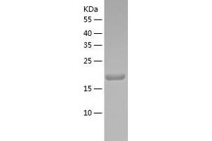 Western Blotting (WB) image for Metadherin (MTDH) (AA 271-456) protein (His tag) (ABIN7287794) (MTDH Protein (AA 271-456) (His tag))