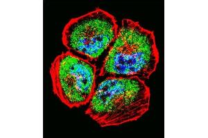 Immunofluorescence (IF) image for anti-Matrix Metallopeptidase 3 (Stromelysin 1, Progelatinase) (MMP3) (AA 30-59), (N-Term) antibody (ABIN657459)
