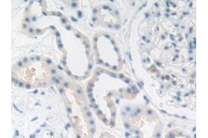 Immunohistochemistry (IHC) image for anti-Carcinoembryonic Antigen Gene Family (CEA) (AA 448-572) antibody (ABIN7440053)