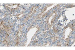 ABIN6276905 at 1/100 staining Human prostate tissue by IHC-P. (IL2RG Antikörper  (N-Term))