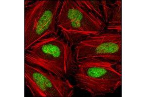 Confocal immunofluorescence analysis of Hela cells using CHK2 mouse mAb (green), showing nuclear localization. (CHEK2 Antikörper)