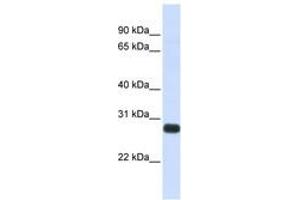 Image no. 1 for anti-serine Peptidase Inhibitor, Kunitz Type, 2 (SPINT2) (AA 180-229) antibody (ABIN6741061) (SPINT2 Antikörper  (AA 180-229))