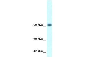 WB Suggested Anti-RBM10 Antibody Titration:  1. (RBM10 Antikörper  (N-Term))