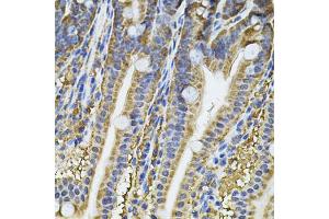 Immunohistochemistry of paraffin-embedded mouse intestine using NFU1 Antibody (ABIN5975479) at dilution of 1/100 (40x lens). (NFU1 Antikörper)