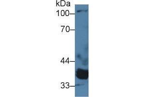 Western Blotting (WB) image for anti-Protein Phosphatase, Mg2+/Mn2+ Dependent, 1A (PPM1A) (AA 2-382) antibody (ABIN7441469)