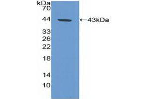 Western blot analysis of recombinant Human CA9. (CA9 Antikörper  (AA 59-414))