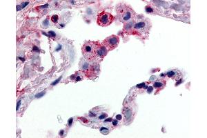 Anti-GPR43 antibody IHC of human lung, alveolar macrophages.
