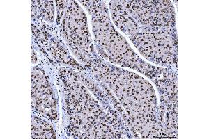 IHC analysis of MBNL1 using anti-MBNL1 antibody (ABIN7602608). (MBNL1 Antikörper  (AA 89-388))