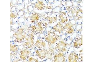 Immunohistochemistry of paraffin-embedded Mouse kidney using MAS1 Polyclonal Antibody at dilution of 1:100 (40x lens). (MAS1 Antikörper)