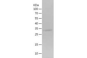 Western Blotting (WB) image for Glycoprotein Hormones, alpha Polypeptide (CGA) (AA 25-116) protein (His-IF2DI Tag) (ABIN7123167) (CGA Protein (AA 25-116) (His-IF2DI Tag))