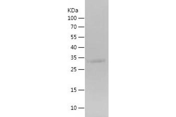 CGA Protein (AA 25-116) (His-IF2DI Tag)