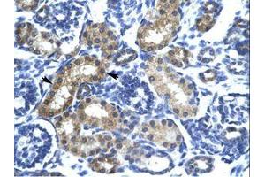 Image no. 1 for anti-SIX Homeobox 6 (SIX6) (AA 41-90) antibody (ABIN6735817) (SIX Homeobox 6 Antikörper  (AA 41-90))