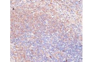 Immunohistochemistry (Paraffin-embedded Sections) (IHC (p)) image for anti-Thioredoxin-Related Transmembrane Protein 1 (TMX1) antibody (ABIN7258224)