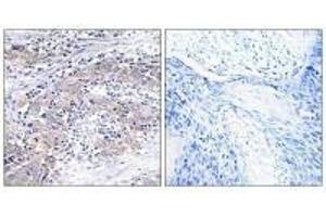 Immunohistochemistry analysis of paraffin-embedded human cervix tissue using CLN6 antibody. (CLN6 Antikörper)