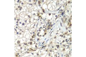 Immunohistochemistry (Paraffin-embedded Sections) (IHC (p)) image for anti-Alveolar Soft Part Sarcoma Chromosome Region, Candidate 1 (ASPSCR1) (AA 284-553) antibody (ABIN6137219)