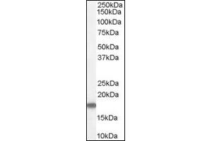 Image no. 1 for anti-Stathmin 1 (STMN1) (C-Term) antibody (ABIN374648) (Stathmin 1 Antikörper  (C-Term))