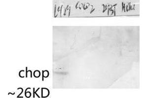 Western Blotting (WB) image for anti-DNA-Damage-Inducible Transcript 3 (DDIT3) (Ser301) antibody (ABIN3183910)