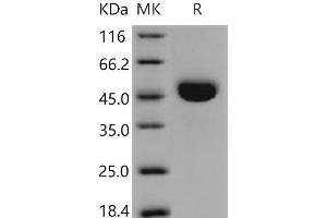 Western Blotting (WB) image for Cathepsin E (CTSE) (AA 1-397) protein (His tag) (ABIN7194677) (Cathepsin E Protein (CTSE) (AA 1-397) (His tag))