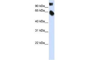 WB Suggested Anti-TSC22D2 Antibody Titration:  0. (TSC22D2 Antikörper  (C-Term))