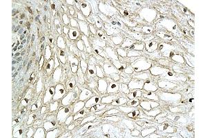 Formalin-fixed and paraffin embedded human cervical tissue labeled with Anti-XBP-1 Polyclonal Antibody, Unconjugated (ABIN732728) followed by conjugation to the secondary antibody and DAB staining (XBP1 Antikörper  (AA 51-150))