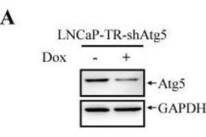 Western Blotting (WB) image for anti-Glyceraldehyde-3-Phosphate Dehydrogenase (GAPDH) antibody (ABIN2857072)