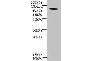 Western blot All lanes: PPFIBP2 antibody at 6 μg/mL + HepG2 whole cell lysate Secondary Goat polyclonal to rabbit at 1/10000 dilution Predicted band size: 99, 87, 84 kDa Observed band size: 99 kDa (PPFIBP2 Antikörper  (AA 101-400))
