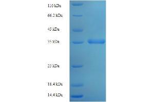SDS-PAGE (SDS) image for MpV17 Mitochondrial Inner Membrane Protein (MPV17) (AA 1-176), (full length) protein (His-SUMO Tag) (ABIN5709955) (MPV17 Protein (AA 1-176, full length) (His-SUMO Tag))