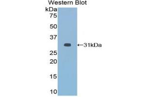 Detection of Recombinant HDAC6, Mouse using Polyclonal Antibody to Histone Deacetylase 6 (HDAC6) (HDAC6 Antikörper  (AA 560-811))