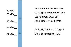 WB Suggested Anti-BBS4  Antibody Titration: 0. (BBS4 Antikörper  (N-Term))