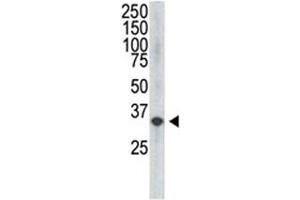 The VEGF4 antibody used in western blot to detect VEGF4 in HDMEC cell lysate (VEGFD Antikörper  (C-Term, N-Term))