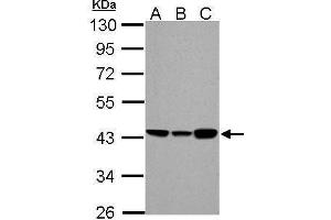 WB Image ACADM antibody detects ACADM protein by Western blot analysis. (Medium-Chain Specific Acyl-CoA Dehydrogenase, Mitochondrial (Center) Antikörper)