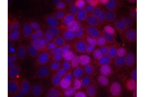 Immunofluorescence staining of methanol-fixed MCF-7 cells using Phospho-ESR1-S106 antibody (ABIN2988004). (Estrogen Receptor alpha Antikörper  (pSer106))
