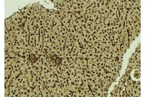 ABIN6276974 at 1/100 staining Mouse liver tissue by IHC-P. (SMAD5 Antikörper  (Internal Region))
