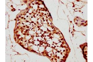 IHC image of ABIN7161945 diluted at 1:200 and staining in paraffin-embedded human testis tissue performed on a Leica BondTM system. (TNP2 Antikörper  (AA 1-138))