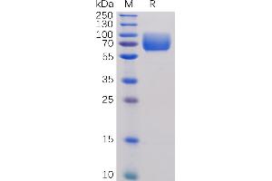 Human B7-2 Protein, hFc Tag on SDS-PAGE under reducing condition.