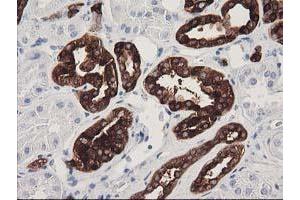 Immunohistochemical staining of paraffin-embedded Human Kidney tissue using anti-ATP6V1B1 mouse monoclonal antibody. (ATP6V1B1 Antikörper)