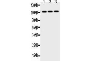 Western blot analysis of AP2B1 expression in rat testis extract ( Lane 1), mouse brain extract ( Lane 2) and MCF-7 whole cell lysates ( Lane 3). (AP2B1 Antikörper  (AA 311-522))