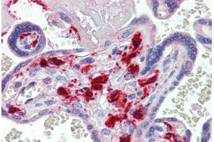 Human Placenta (formalin-fixed, paraffin-embedded) stained with F13A1 antibody ABIN462397 followed by biotinylated secondary antibody, alkaline phosphatase-streptavidin and chromogen. (F13A1 Antikörper)
