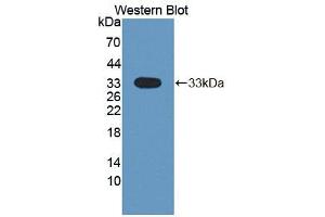 Western blot analysis of the recombinant protein. (DSTYK Antikörper  (AA 650-904))